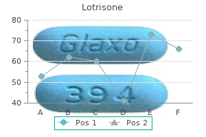 lotrisone 10 mg low price