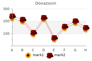 doxazosin 1 mg order with visa