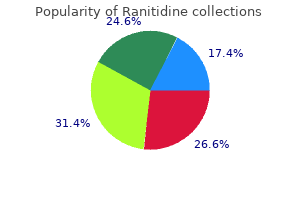 ranitidine 300 mg order free shipping