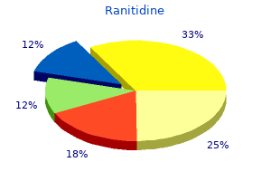 generic ranitidine 300 mg buy on-line