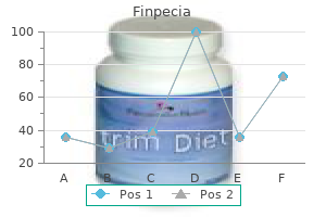 order 1 mg finpecia visa