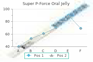 buy 160 mg super p-force oral jelly free shipping
