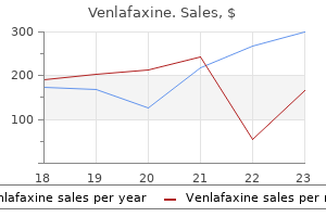 purchase 150 mg venlafaxine with visa